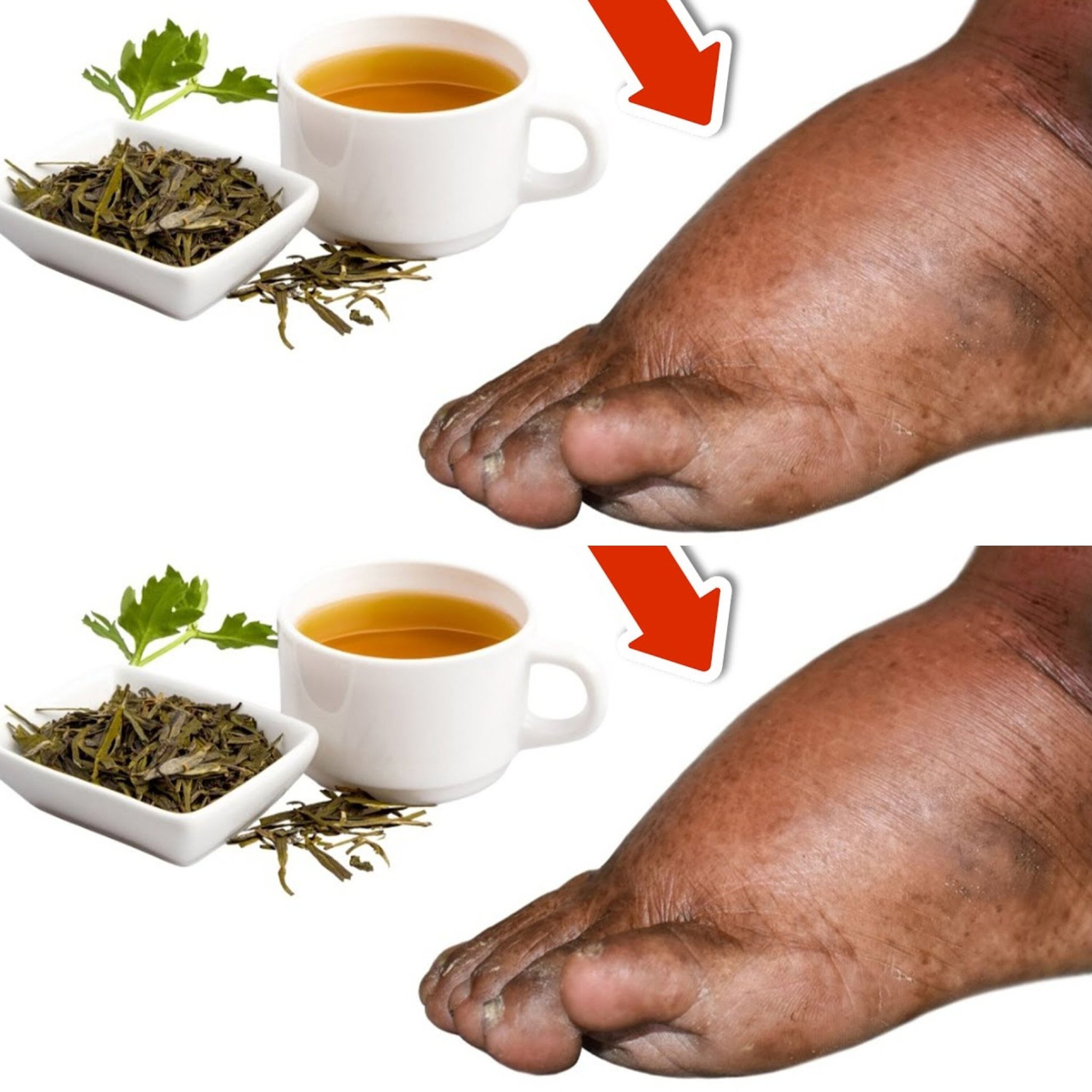 Sip Away Swelling: Discover the Herbal Tea That Soothes Swollen Legs, Ankles, and Feet