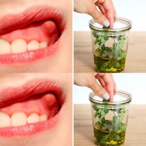 Use Oregano Oil to Naturally Treat Dental Infections and Tooth Abscesses