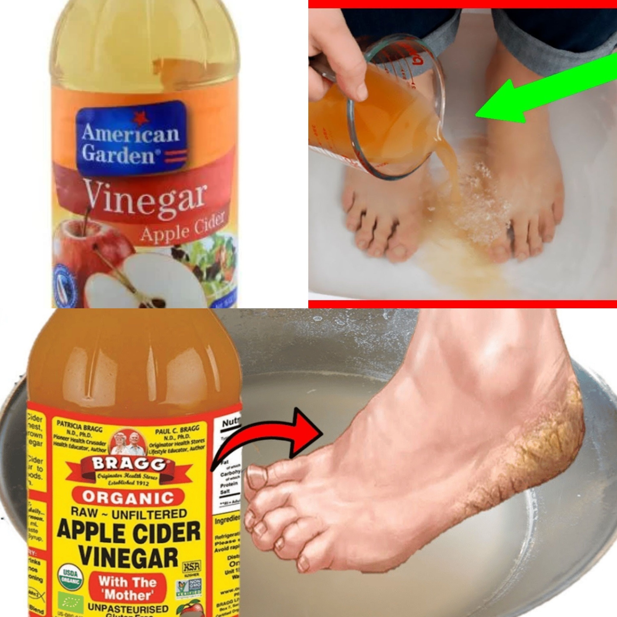 Revive Tired Feet and Eliminate Toxins With This DIY Foot Detox Soak Using Apple Cider Vinegar