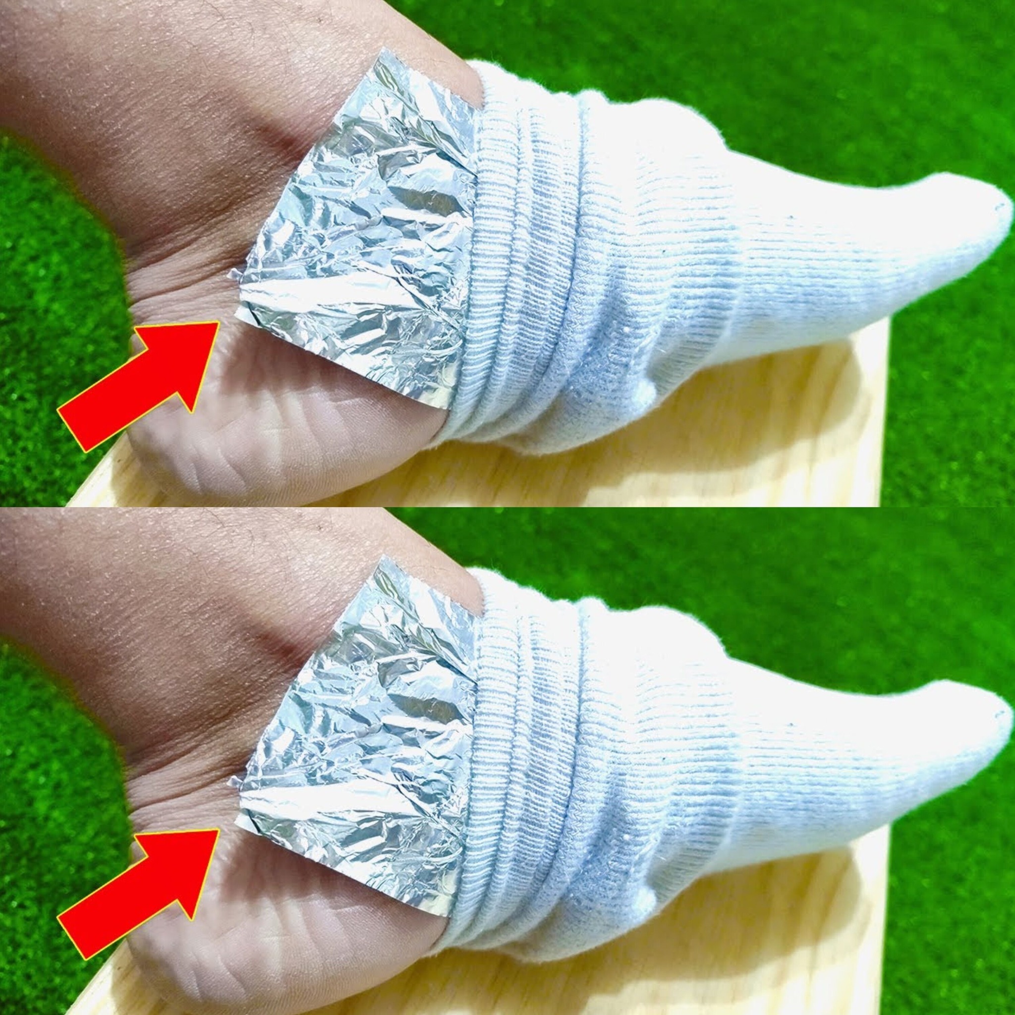 Wrap Your Feet in Aluminum Foil: A Surprising Home Remedy You Should Try