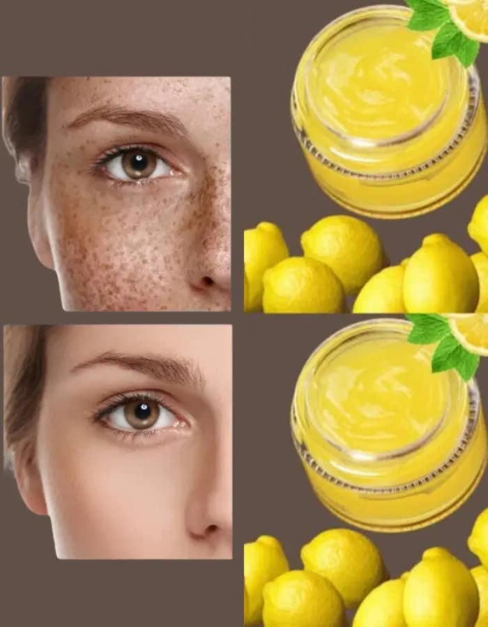 Vitamin C Cream for Face: Unlock the Skin Whitening Secret