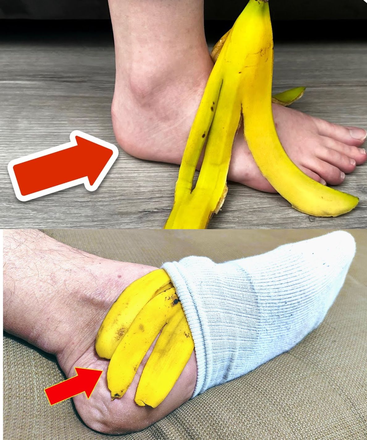 Banana Peel on Your Feet: A Surprising Natural Remedy You’ll Love