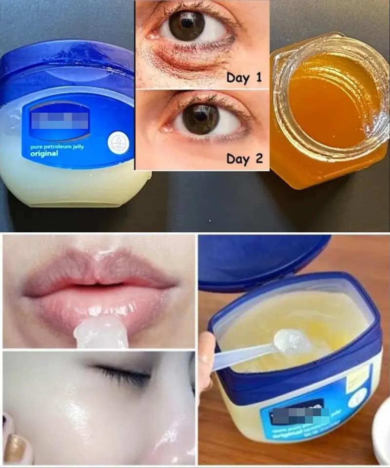 Fast Remedy: Get Rid of Eye Bags and Dark Circles