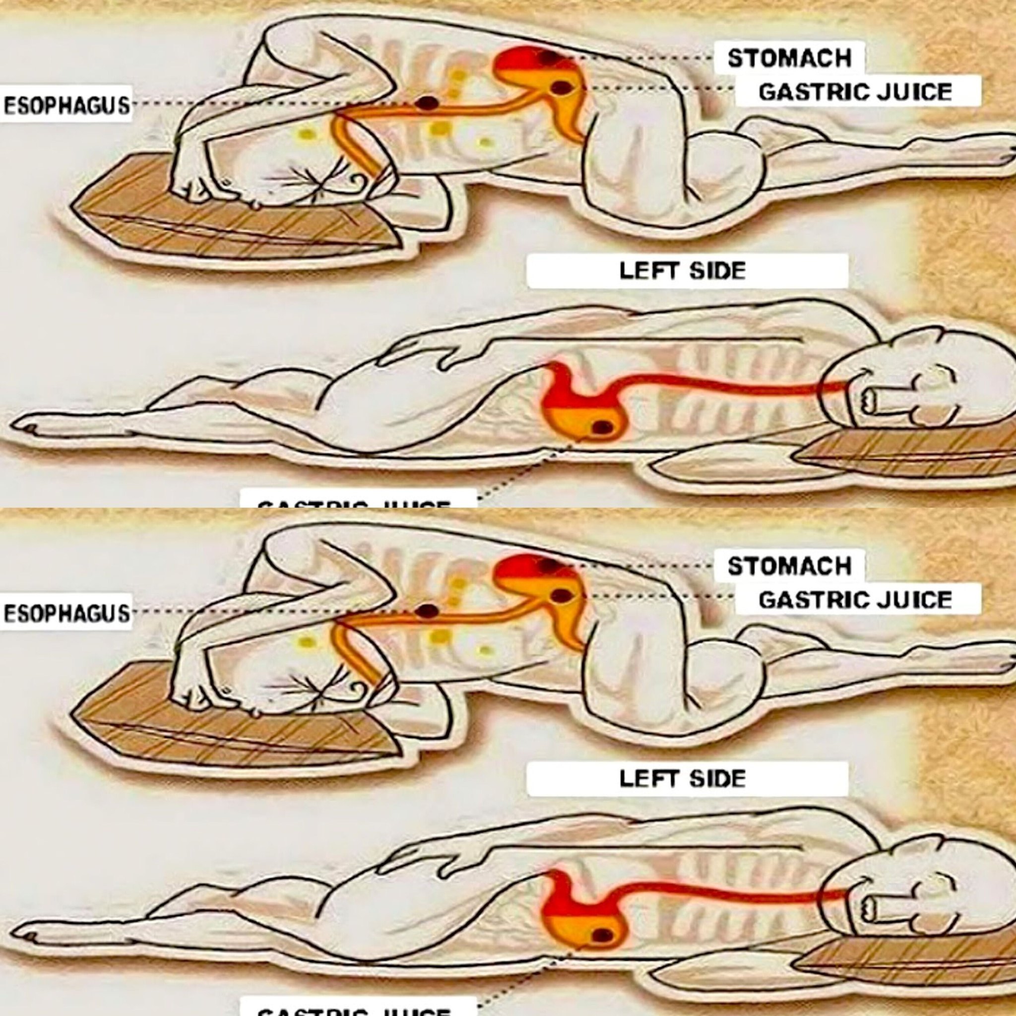 Why Sleeping on Your Left Side Could Benefit Your Health