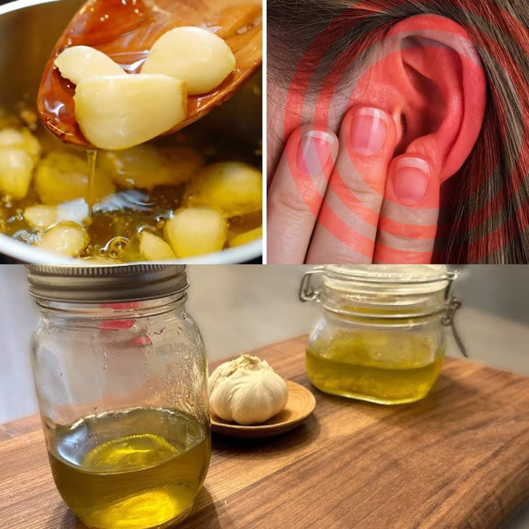 How to Make Garlic Oil Ear Drops for Ear Infections and Ear Aches