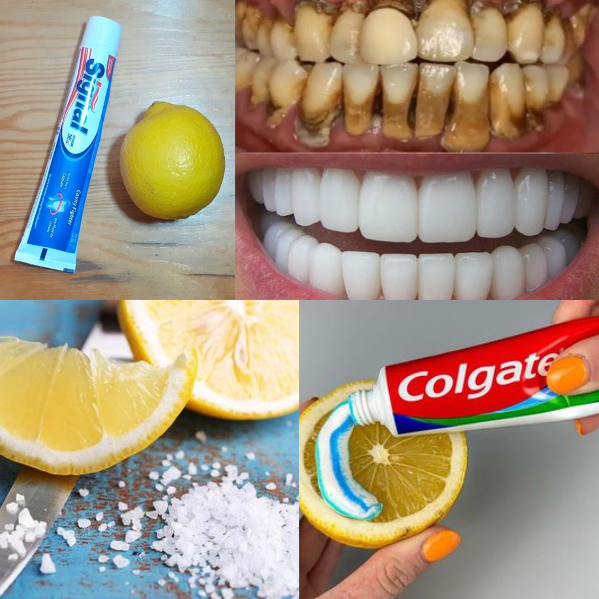 Brighten Your Smile: Natural Toothpaste and Lemon Whitening Recipe