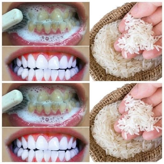 Brighten Your Smile in Just One Minute – A Simple DIY Teeth Whitening Trick!