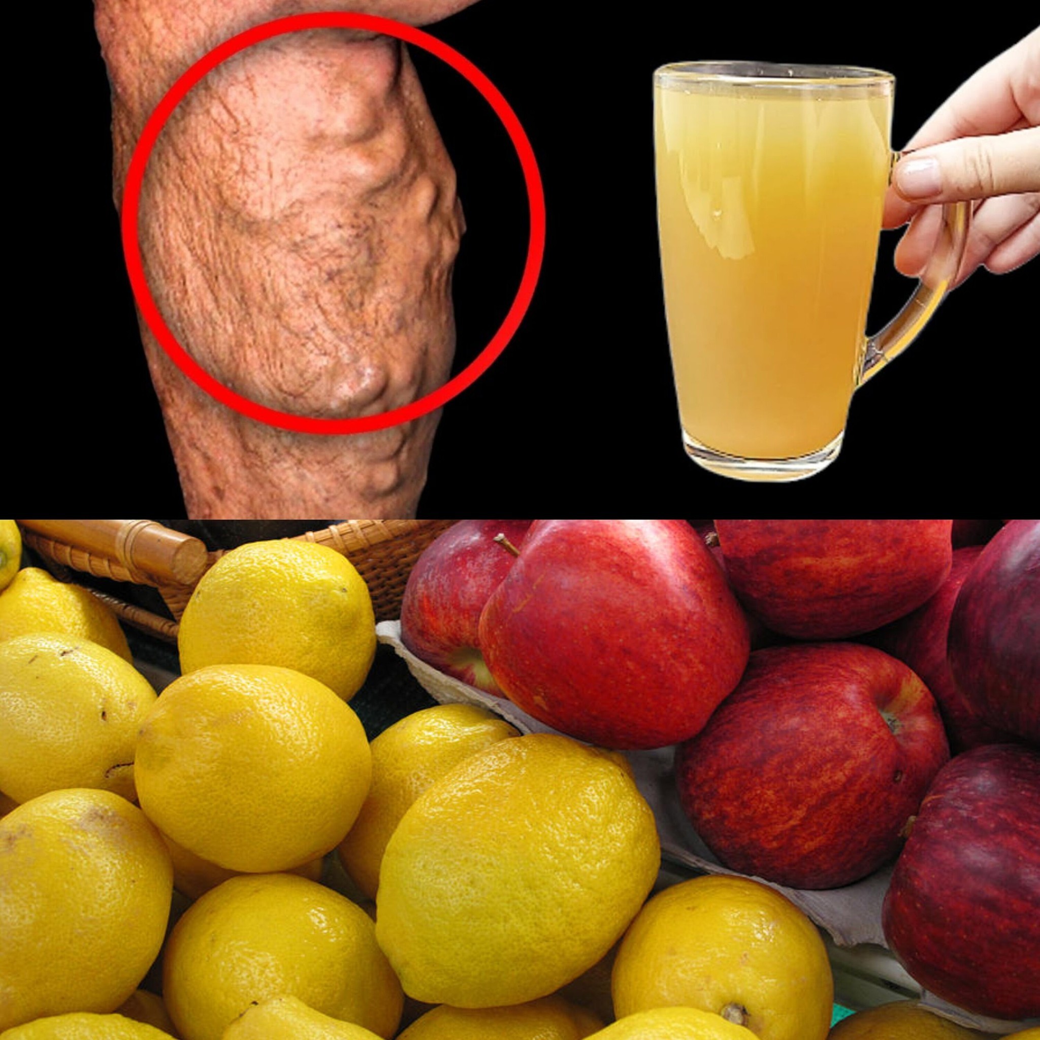 I AM SHOCKED! Instantly Dissolves Blood Clots and Makes the Blood Fluid with Apple and Lemon Juice!