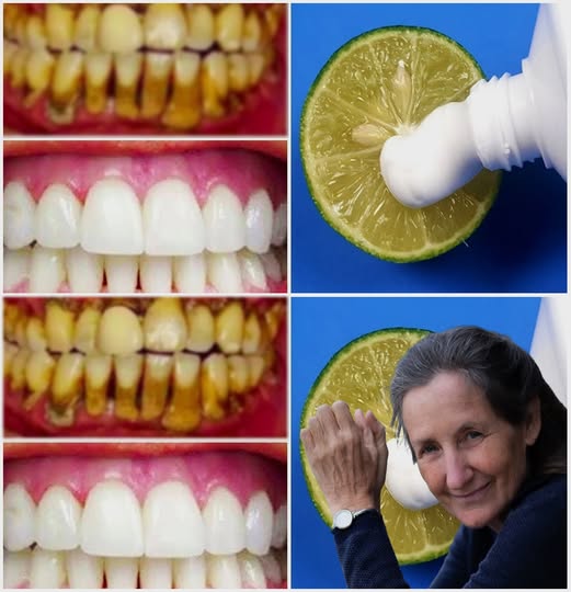 In just two minutes: Naturally whiten your teeth with this method