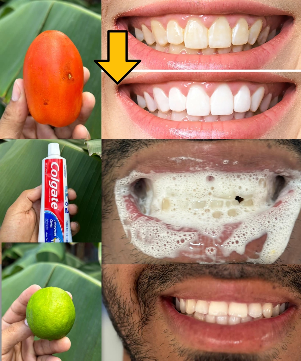 Say Goodbye to Yellow Teeth with This Natural Recipe! Get Whiter Teeth in Just Minutes Without Spending Money at the Dentist 