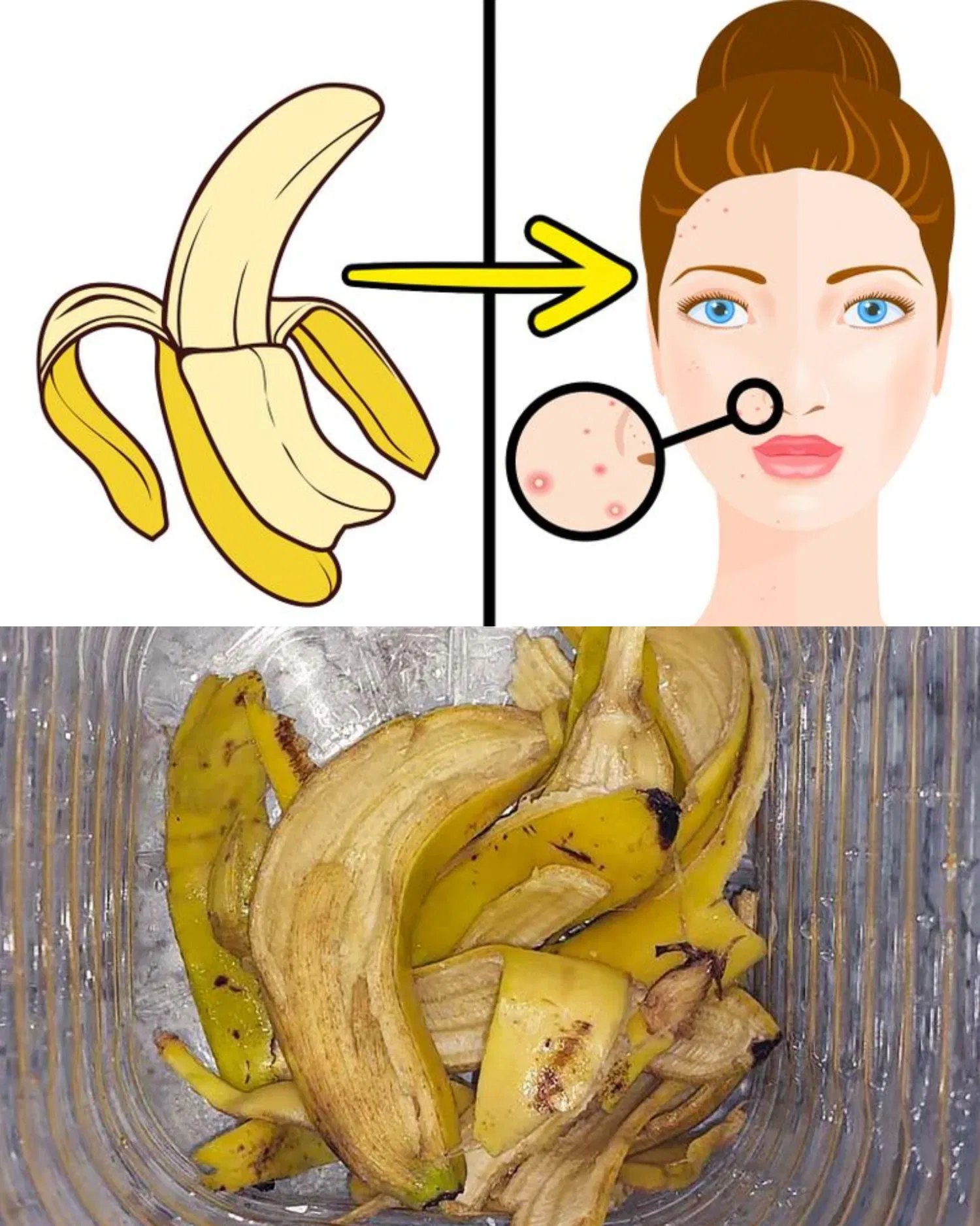 Banana Peel Erases Wrinkles! Best Banana Peel Recipe for Skin Care!