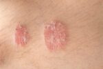 If you notice these signs on your body, consult a doctor immediately