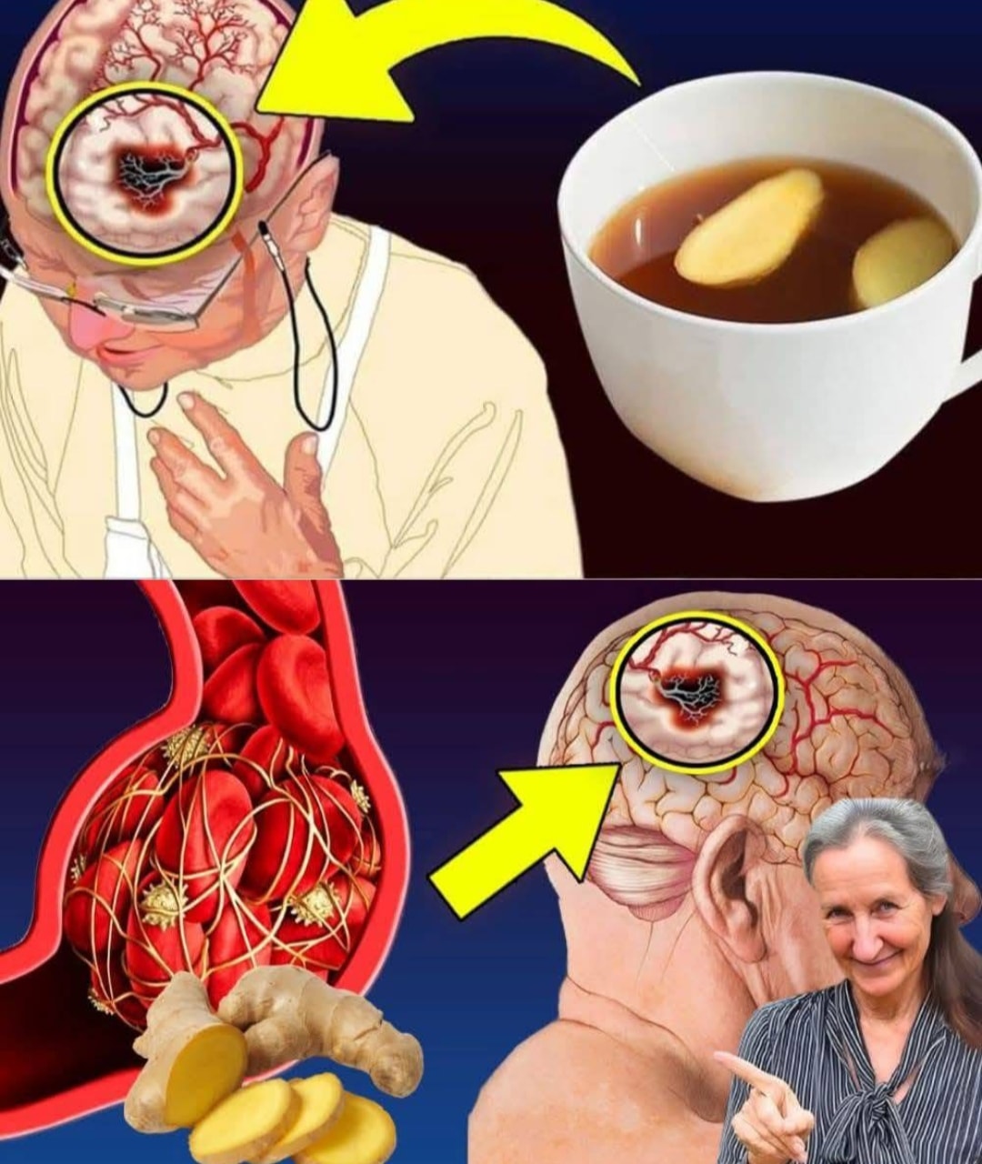 Better Than Aspirin! Ginger Tea Prevents Clots Naturally