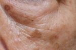If you dont have enough of this 1 mineral you will more likely get age spots